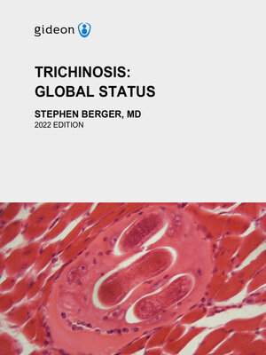 cover image of Trichinosis